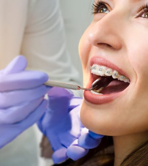 Young woman with braces receiving a dental exam