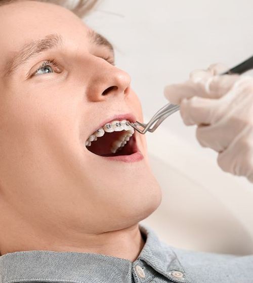 Man with braces visiting his Aetna orthodontist in Allen