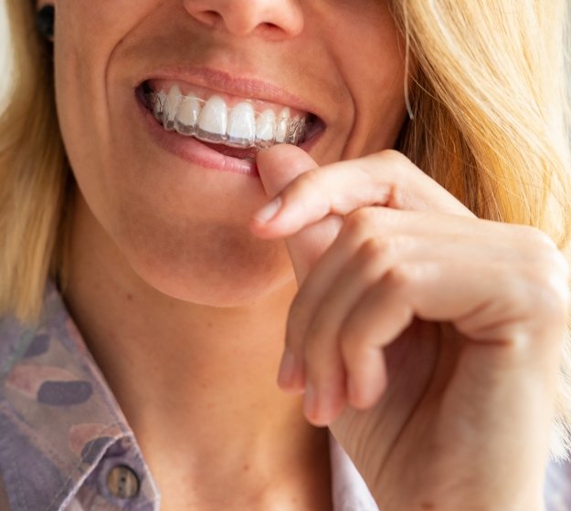 Blonde woman placing an Invisalign aligner over her teeth