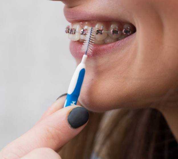 Close up of a person with braces flossing